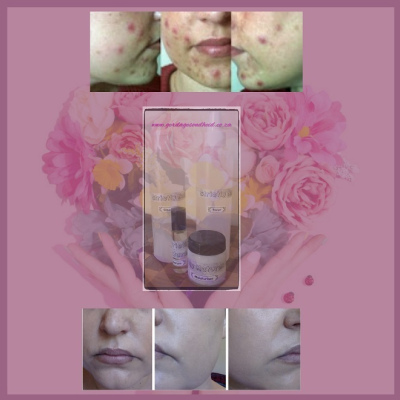Gerda's Health & Beauty Facial Care Combo R500: Cleanser, Toner, Moisturiser, Treatment incl delivery